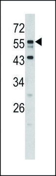 ANTI-DONSON (N-TERM) antibody produced in