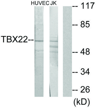 Anti-TBX22 antibody produced in rabbit