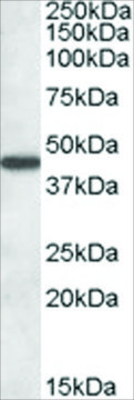Anti-AADAT antibody produced in goat