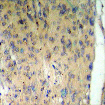 Anti-phospho-BAD (pSer¹³?) antibody produced in