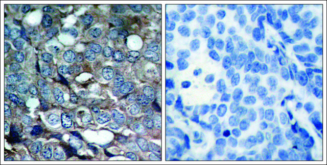 Anti-phospho-MAP3K5 (pSer?³) antibody produced in