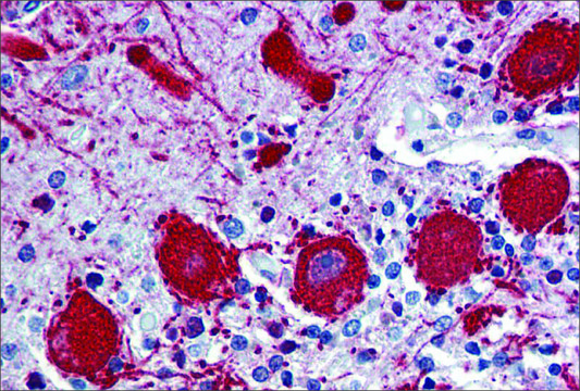 Anti-VEZF1 antibody produced in rabbit