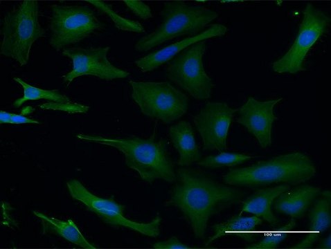 Monoclonal Anti-PAFAH1B1, (N-terminal) antibody produced