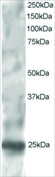Anti-RGS1/1R20 antibody produced in goat