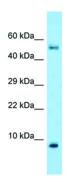 Anti-S100A10 antibody produced in rabbit