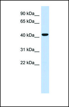 Anti-SGMS2, (N-terminal) antibody produced in
