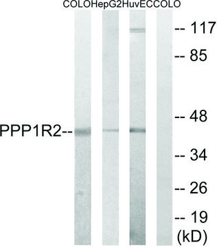 Anti-PPP1R2 antibody produced in rabbit