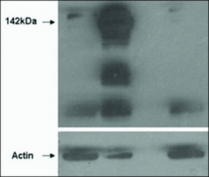 Anti-TNKS (N-terminal) antibody produced in