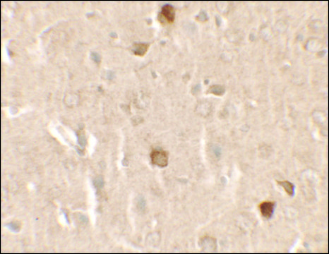 Anti-CNRIP1 antibody produced in rabbit