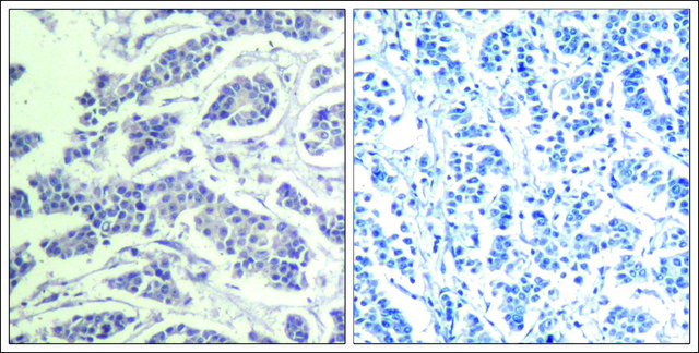 Anti-phospho-AKT1/AKT2/AKT3 (pTyr³¹?/pTyr³¹?/pTyr³¹²) antibody produced in