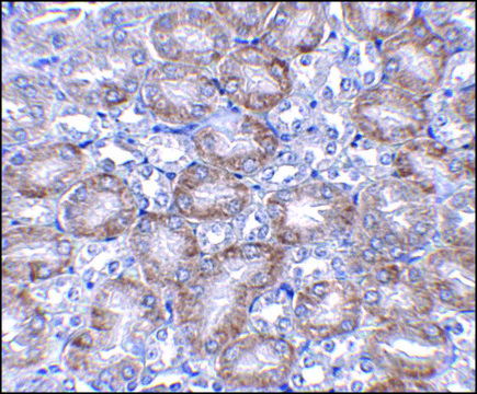 Anti-MTCH2 antibody produced in rabbit