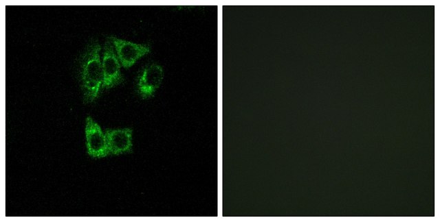 Anti-GIMAP2 antibody produced in rabbit