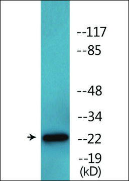 Anti-phospho-Claudin 6 (pTyr²¹?) antibody produced