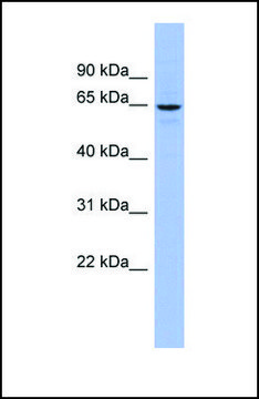 Anti-SLC34A3 antibody produced in rabbit