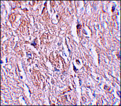 Anti-LRRTM4 antibody produced in rabbit