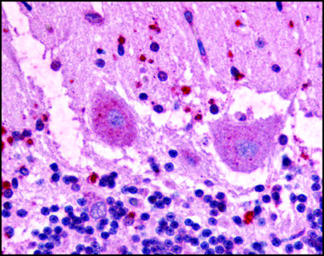 Anti-GPR3 (AB2) antibody produced in