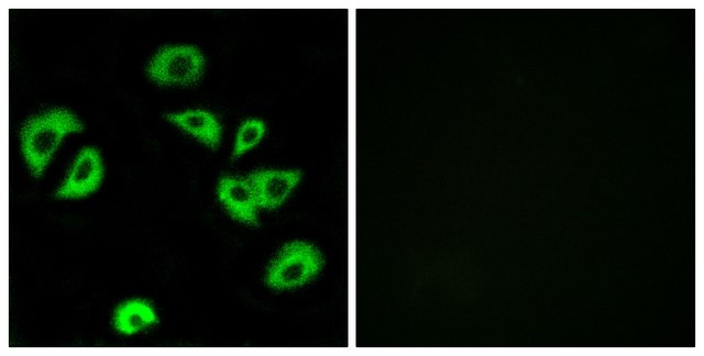 Anti-LILRB4 antibody produced in rabbit