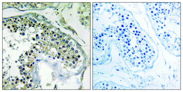 Anti-PPP1R1C antibody produced in rabbit