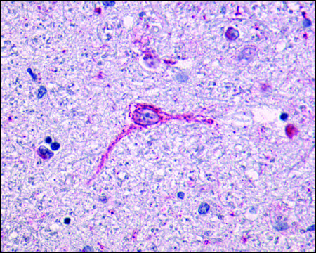 Anti-NTSR1 antibody produced in rabbit
