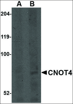 Anti-CNOT4 antibody produced in rabbit