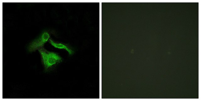 Anti-GPR149 antibody produced in rabbit