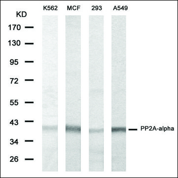 Anti-PPP2R2A antibody produced in rabbit
