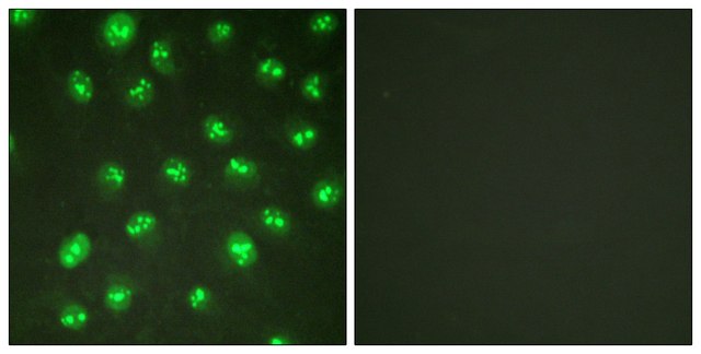 Anti-p57 KIP2 antibody produced in
