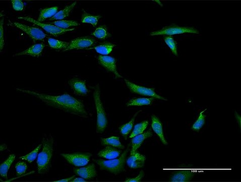 Anti-INPP5B antibody produced in rabbit