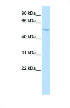 Anti-SUFU antibody produced in rabbit