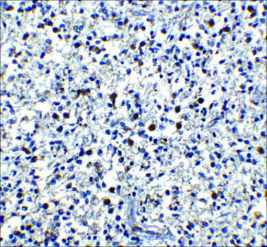 Anti-Cathelicidin antibody produced in rabbit