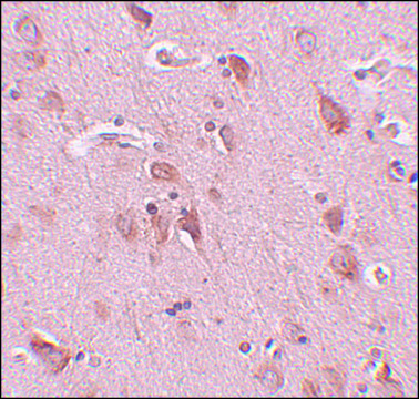 Anti-FAM59B antibody produced in rabbit