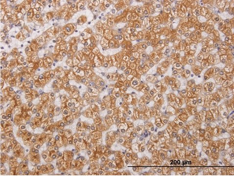 Monoclonal Anti-RIPK4, (C-terminal) antibody produced