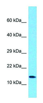 Anti-ATP5F1D antibody produced in rabbit