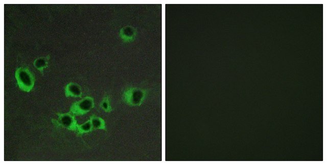 Anti-HTR2B antibody produced in rabbit