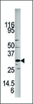 Anti-PPM1E (N-term) antibody produced in