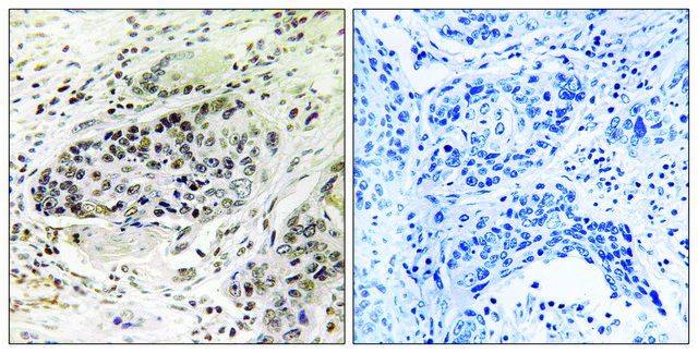 Anti-APBA2 antibody produced in rabbit