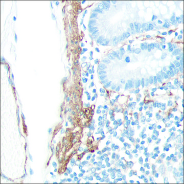 Anti-SMA antibody, Rabbit monoclonal