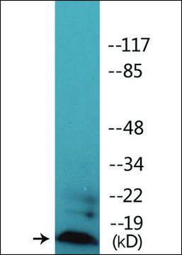 Anti-phospho-Synuclein (pSer¹²?) antibody produced in