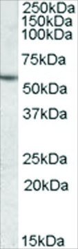 Anti-CES1 antibody produced in goat