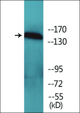 Anti-phospho-VEGFR1 (pTyr¹³³³) antibody produced in