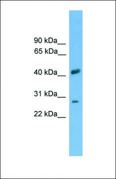 Anti-SLC25A37 antibody produced in rabbit