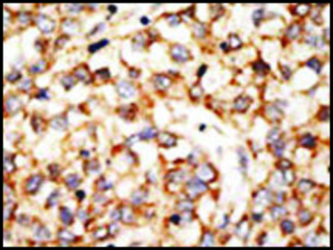 Anti-Apobec1 (N-term) antibody produced in