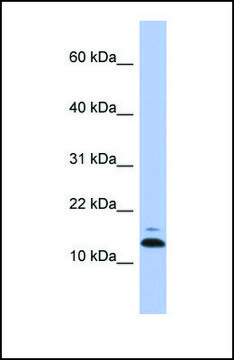 Anti-ASAH1, (N-terminal) antibody produced in