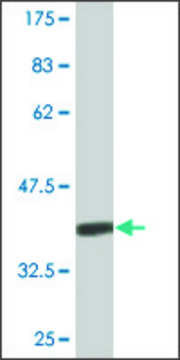 Monoclonal Anti-CENPK antibody produced in