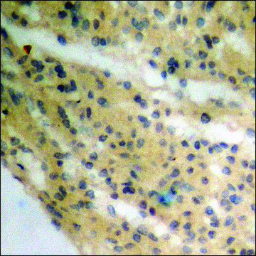 Anti-phospho-p90 RSK (pThr359+Ser363) antibody produced