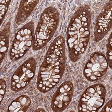 Anti-GGA1 antibody produced in rabbit