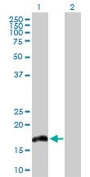 Anti-IL20 antibody produced in rabbit