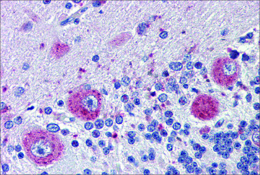 Anti-GRHL2 antibody produced in rabbit