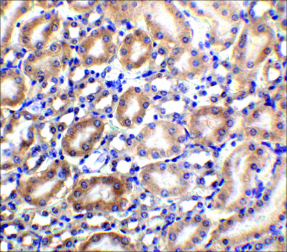 Anti-Slc22A17 antibody produced in rabbit