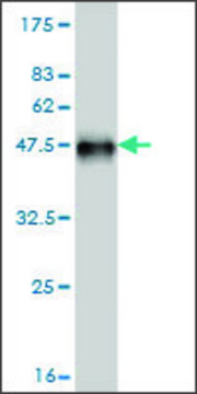 Monoclonal Anti-NEK5 antibody produced in